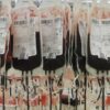 Donazioni di sangue in crescita, nel 2024 aumento del 10% – ASCOLTA