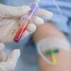 In crescita anche in Toscana le malattie sessuali: “Fare il test è un atto di responsabilitù verso se e gli altri”